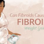 Can Fibroids Cause Weight Gain Can Fibroids Cause Weight Gain